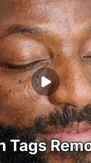 Close view of a client's cheek from a WOB Beauty skin tag reel