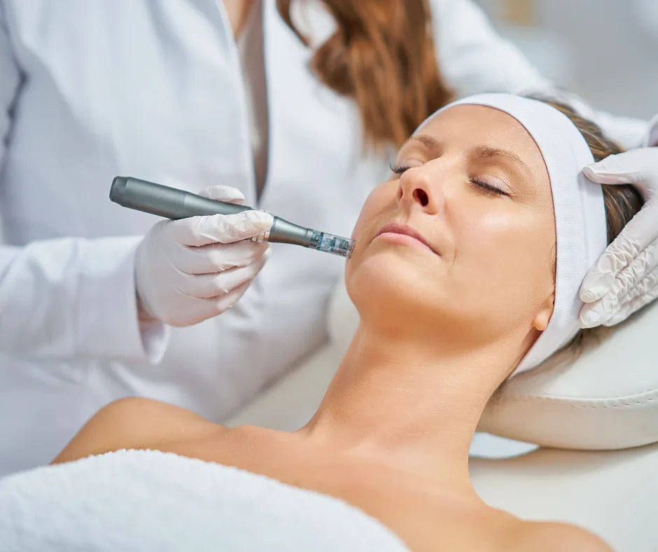 Microneedling treatment at WOB Beauty